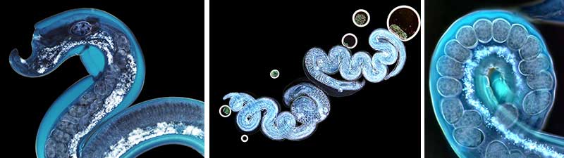 helminth light mircoscopy